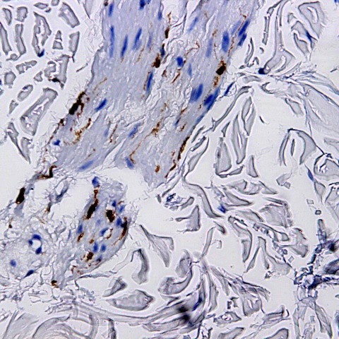 Tat epitope 1 Antibody in Immunohistochemistry (Paraffin) (IHC (P))