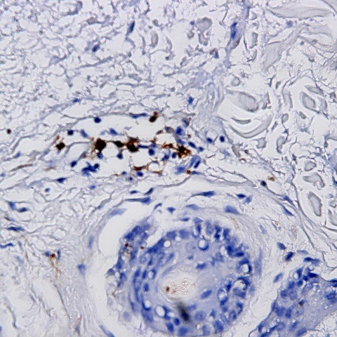 TGF alpha Antibody in Immunohistochemistry (Paraffin) (IHC (P))