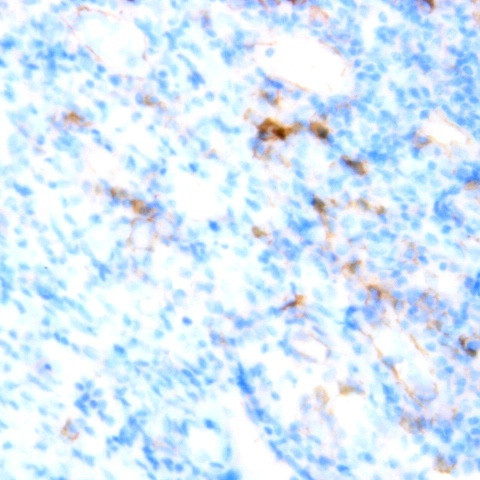 CD61 Antibody in Immunohistochemistry (Paraffin) (IHC (P))