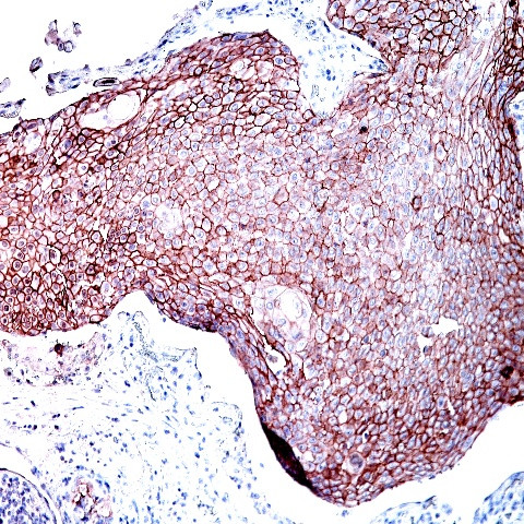 Desmoglein 3 Antibody in Immunohistochemistry (Paraffin) (IHC (P))