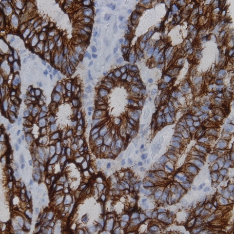 Phosphotyrosine Antibody in Immunohistochemistry (Paraffin) (IHC (P))