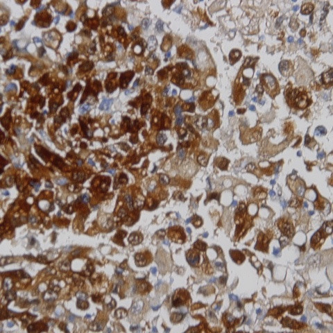 Melanosome Antibody in Immunohistochemistry (Paraffin) (IHC (P))