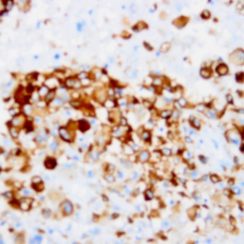 Melan-A/MART-1 Antibody in Immunohistochemistry (Paraffin) (IHC (P))