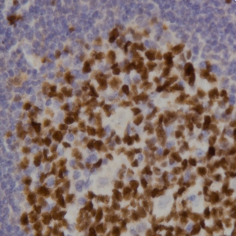 BRCA1 Antibody in Immunohistochemistry (Paraffin) (IHC (P))