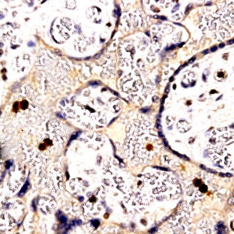 Uroplakin-3 Antibody in Immunohistochemistry (Paraffin) (IHC (P))