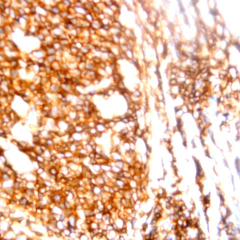 CD25/IL-2R Antibody in Immunohistochemistry (Paraffin) (IHC (P))