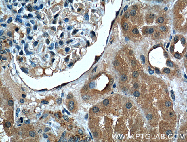 FOLR1 Antibody in Immunohistochemistry (Paraffin) (IHC (P))