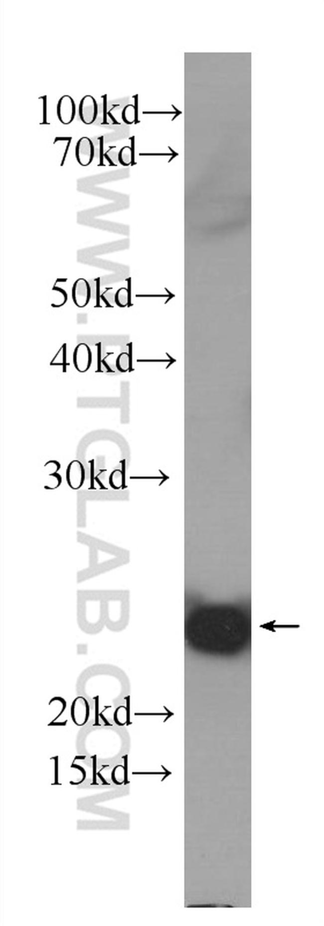 IL1F10 Antibody in Western Blot (WB)