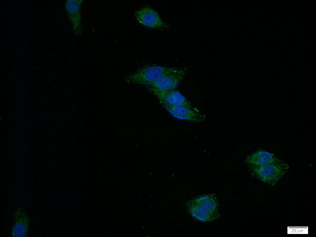 CD39/ENTPD1 Antibody in Immunocytochemistry (ICC/IF)