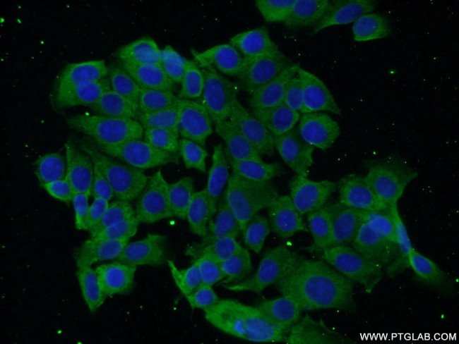 DBC1 Antibody in Immunocytochemistry (ICC/IF)