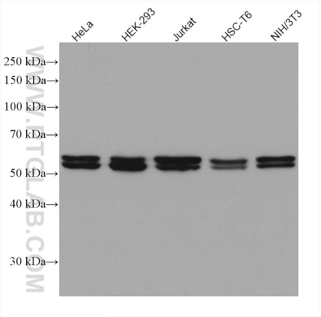 HEXA Antibody in Western Blot (WB)