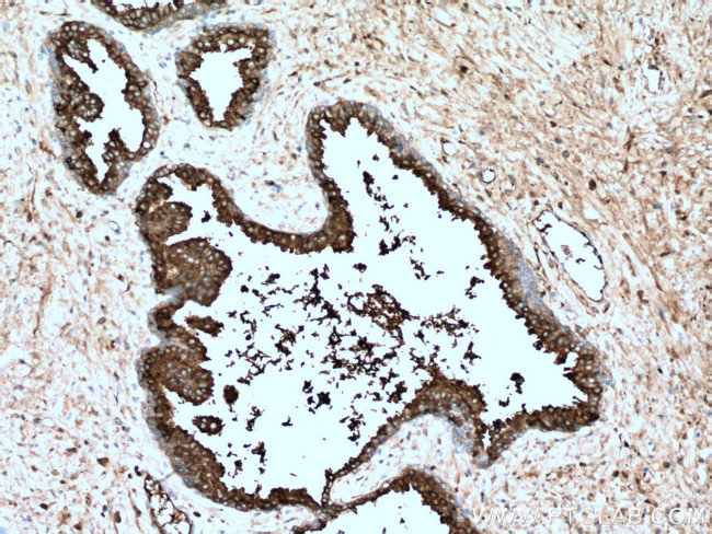 KLK3/PSA Antibody in Immunohistochemistry (Paraffin) (IHC (P))
