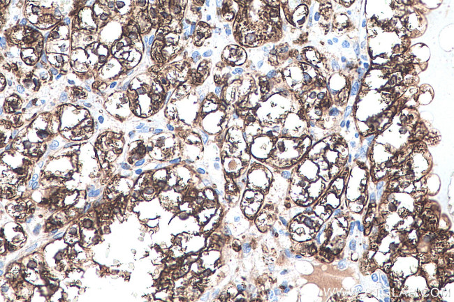 ADRP/Perilipin 2 Antibody in Immunohistochemistry (Paraffin) (IHC (P))