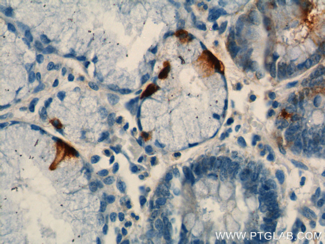 Gastrin Antibody in Immunohistochemistry (Paraffin) (IHC (P))