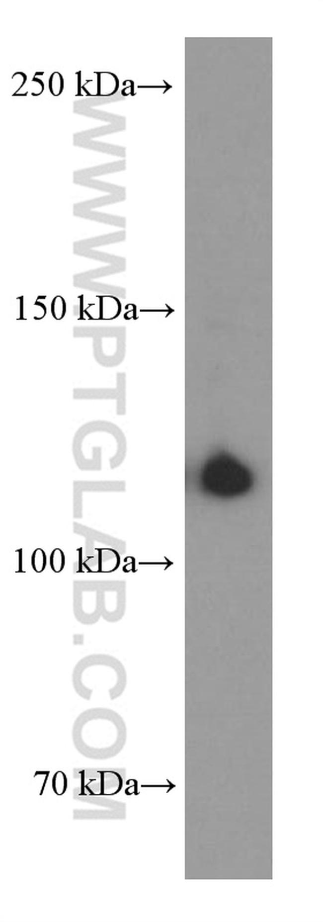 CD41/Integrin alpha 2b Antibody in Western Blot (WB)