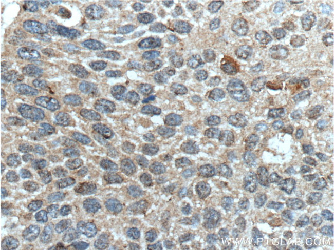 Inhibin beta A Antibody in Immunohistochemistry (Paraffin) (IHC (P))