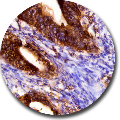 4E-BP1 Antibody in Immunohistochemistry (Paraffin) (IHC (P))