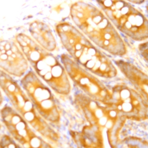 BAX Antibody in Immunohistochemistry (Paraffin) (IHC (P))