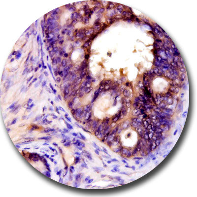CD309/VEGFR2 Antibody in Immunohistochemistry (Paraffin) (IHC (P))