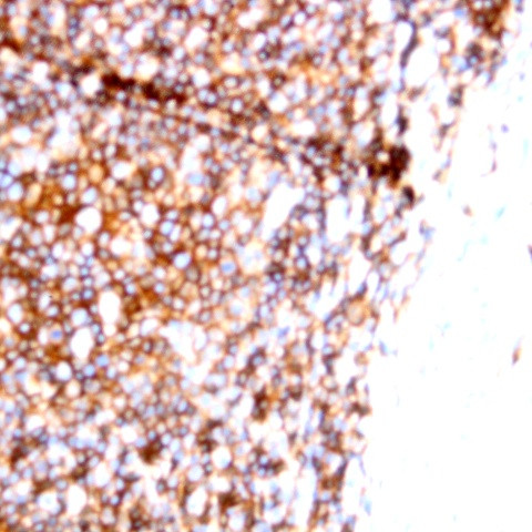 CD22 Antibody in Immunohistochemistry (Paraffin) (IHC (P))
