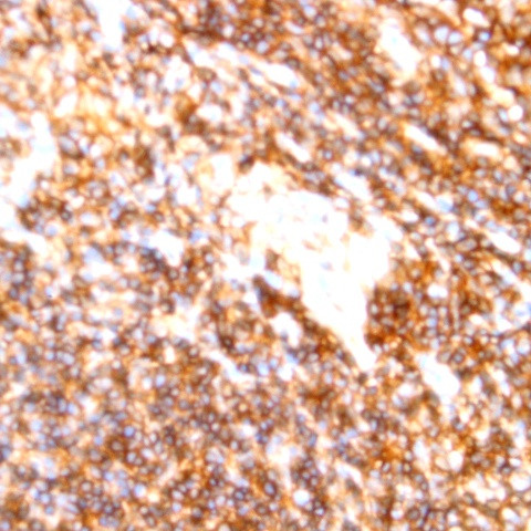 CD22 Antibody in Immunohistochemistry (Paraffin) (IHC (P))