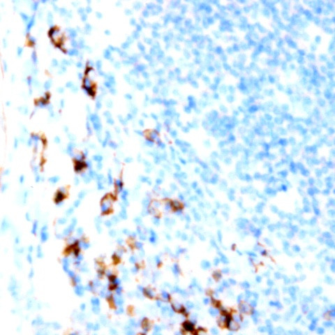 CD28 Antibody in Immunohistochemistry (Paraffin) (IHC (P))