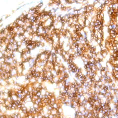 CD30 Antibody in Immunohistochemistry (Paraffin) (IHC (P))