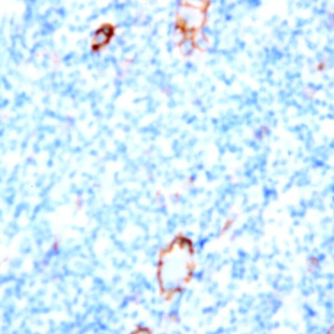 CD38 Antibody in Immunohistochemistry (Paraffin) (IHC (P))