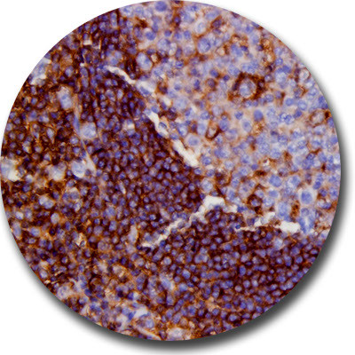 CD44 Antibody in Immunohistochemistry (Paraffin) (IHC (P))