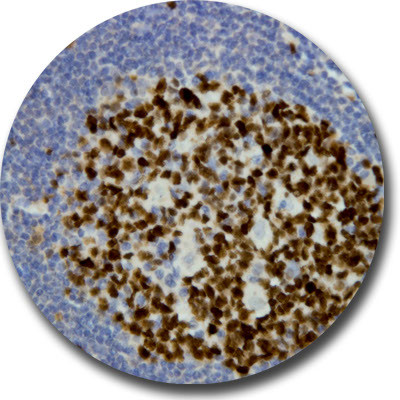 Ki-67 Antibody in Immunohistochemistry (Paraffin) (IHC (P))