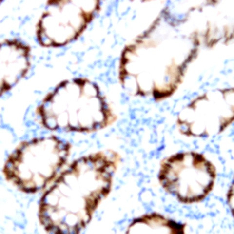 TIA-1 Antibody in Immunohistochemistry (Paraffin) (IHC (P))
