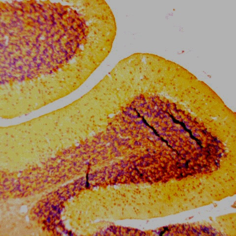 Synaptophysin Antibody in Immunohistochemistry (Paraffin) (IHC (P))