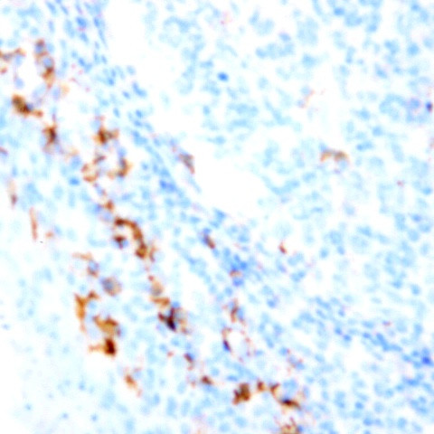 CD36 Antibody in Immunohistochemistry (Paraffin) (IHC (P))