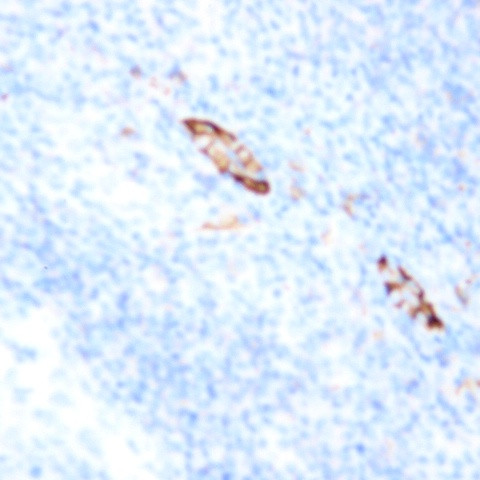 CD38 Antibody in Immunohistochemistry (Paraffin) (IHC (P))