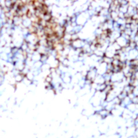 CD71 Antibody in Immunohistochemistry (Paraffin) (IHC (P))