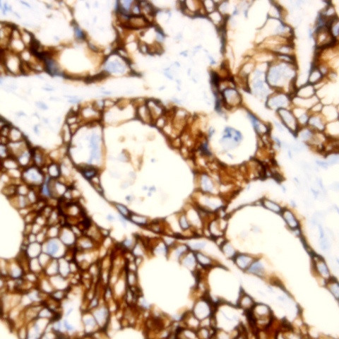 EpCam Antibody in Immunohistochemistry (Paraffin) (IHC (P))