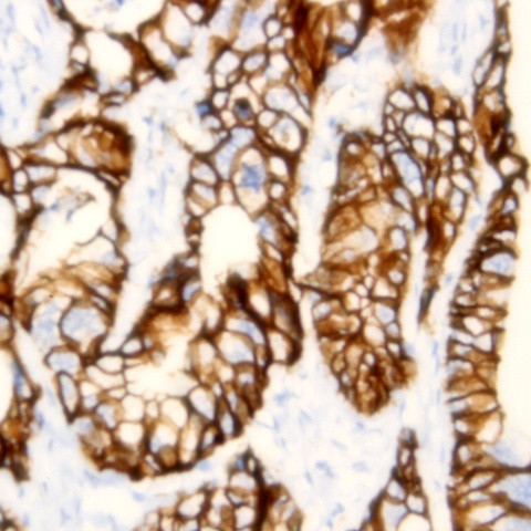 EpCam Antibody in Immunohistochemistry (Paraffin) (IHC (P))