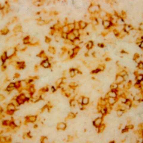 AXL Antibody in Immunohistochemistry (Paraffin) (IHC (P))