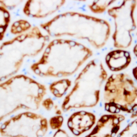Cytokeratin 5 (CK5) Antibody in Immunohistochemistry (Paraffin) (IHC (P))