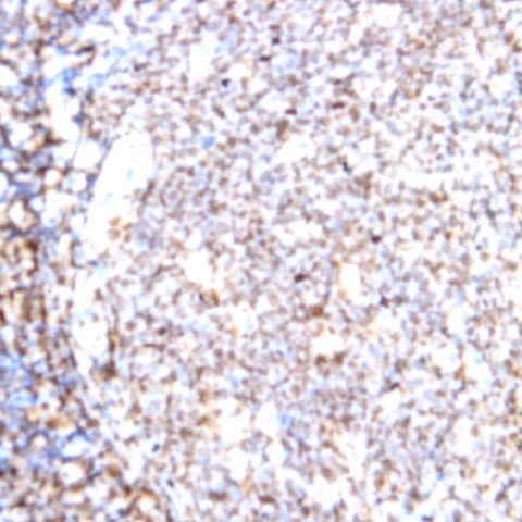 CD71 Antibody in Immunohistochemistry (Paraffin) (IHC (P))