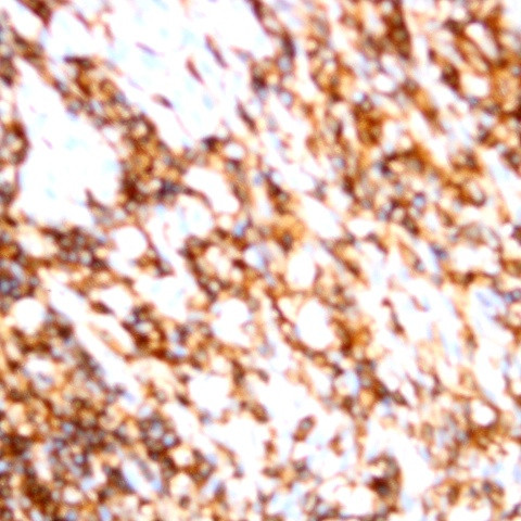 CD79b Antibody in Immunohistochemistry (Paraffin) (IHC (P))