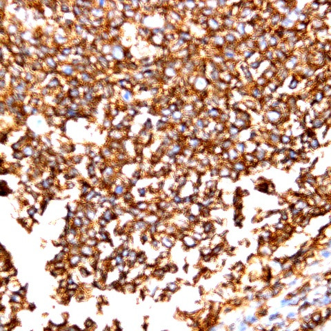 CD55 Antibody in Immunohistochemistry (Paraffin) (IHC (P))