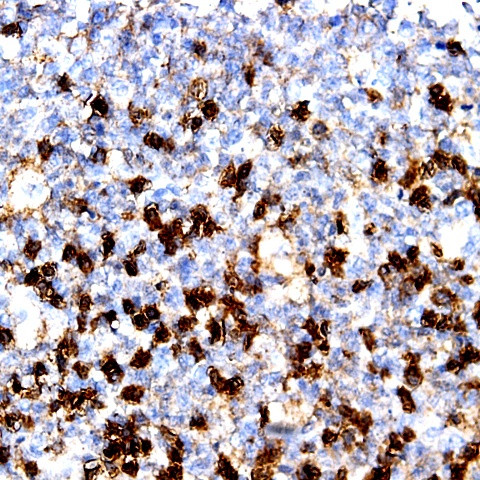 CD34 Antibody in Immunohistochemistry (Paraffin) (IHC (P))