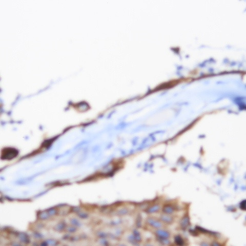 CD117 (c-kit) Antibody in Immunohistochemistry (Paraffin) (IHC (P))