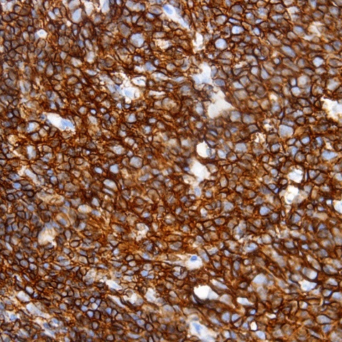 CD3 Antibody in Immunohistochemistry (Paraffin) (IHC (P))
