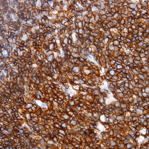 CD3 Antibody in Immunohistochemistry (Paraffin) (IHC (P))