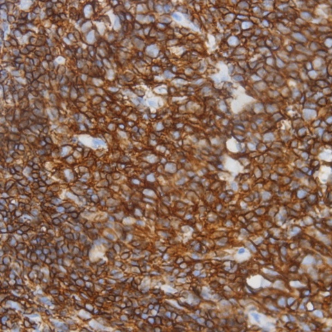 CD3e Antibody in Immunohistochemistry (Paraffin) (IHC (P))