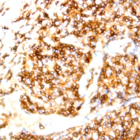 CD15/SSEA-1 Antibody in Immunohistochemistry (Paraffin) (IHC (P))