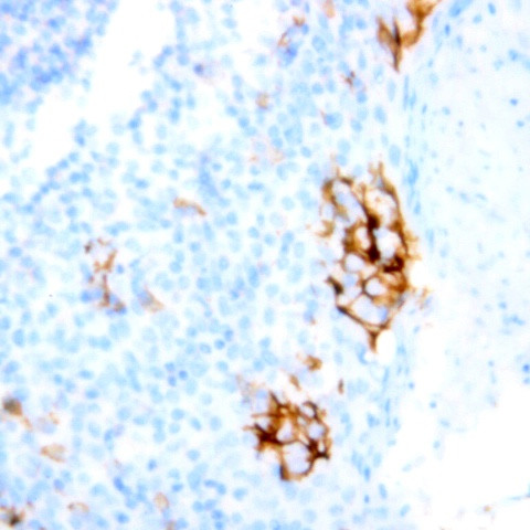 CD74 Antibody in Immunohistochemistry (Paraffin) (IHC (P))
