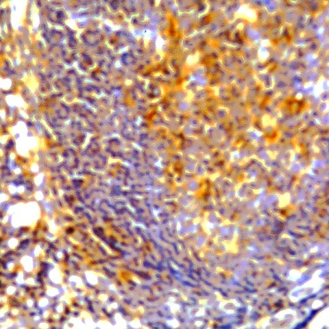PD-L1 Antibody in Immunohistochemistry (Paraffin) (IHC (P))